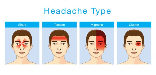 49995306 - illustration about headaches 4 type on different area of patient head.